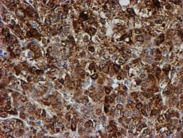 PSMB9 Antibody (clone OTI3H1)
