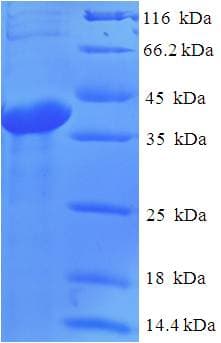 Human ABHD14B Protein (Recombinant His-SUMO)