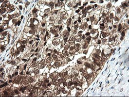 OTUB1 / OTU1 Antibody (clone OTI5F7)