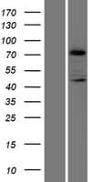 PRKCB / PKC-Beta Protein (Over-Expression Lysate Myc-DDK (Flag))