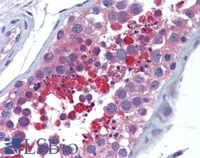 IHC-plus™ MMS2 / UBE2V2 Antibody (aa1-145)