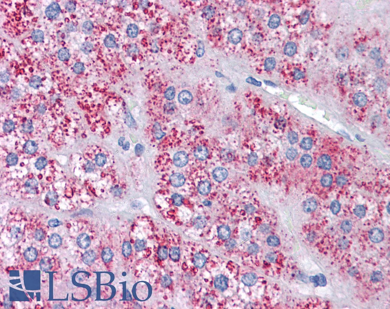IHC-plus™ MTA1 Antibody (Internal)