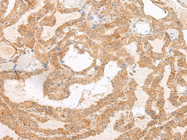 SLC6A9 / GLYT1 Antibody