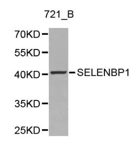 Selenium Binding Protein 1 Antibody