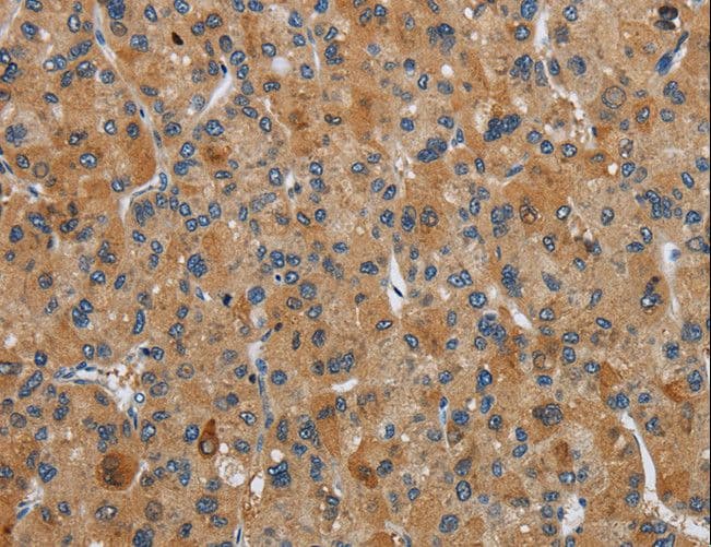 FLCN / Folliculin Antibody