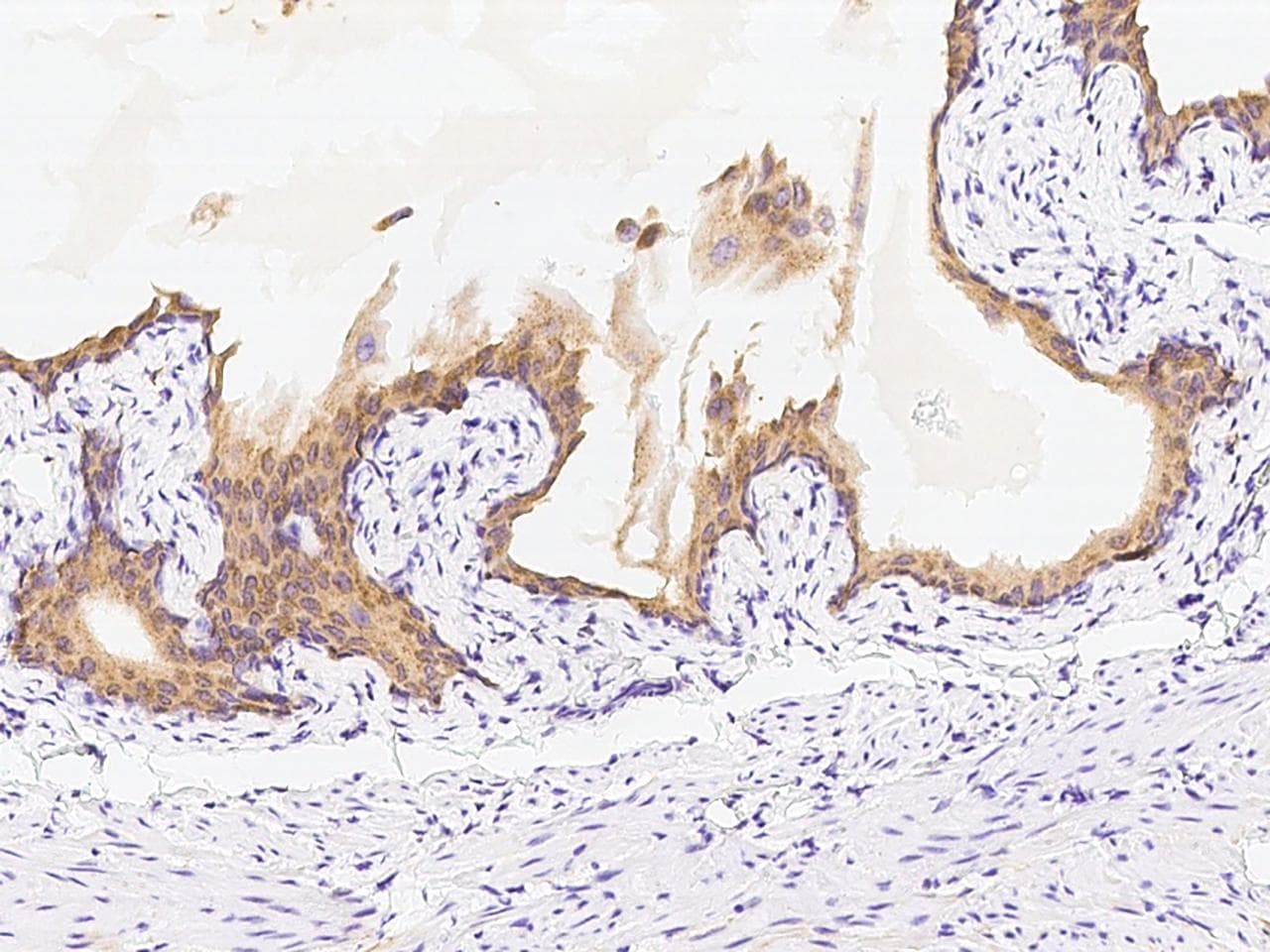 Polyclonal Rabbit anti-Mouse ACPP / PAP Antibody (Preservative Free, IHC, WB)