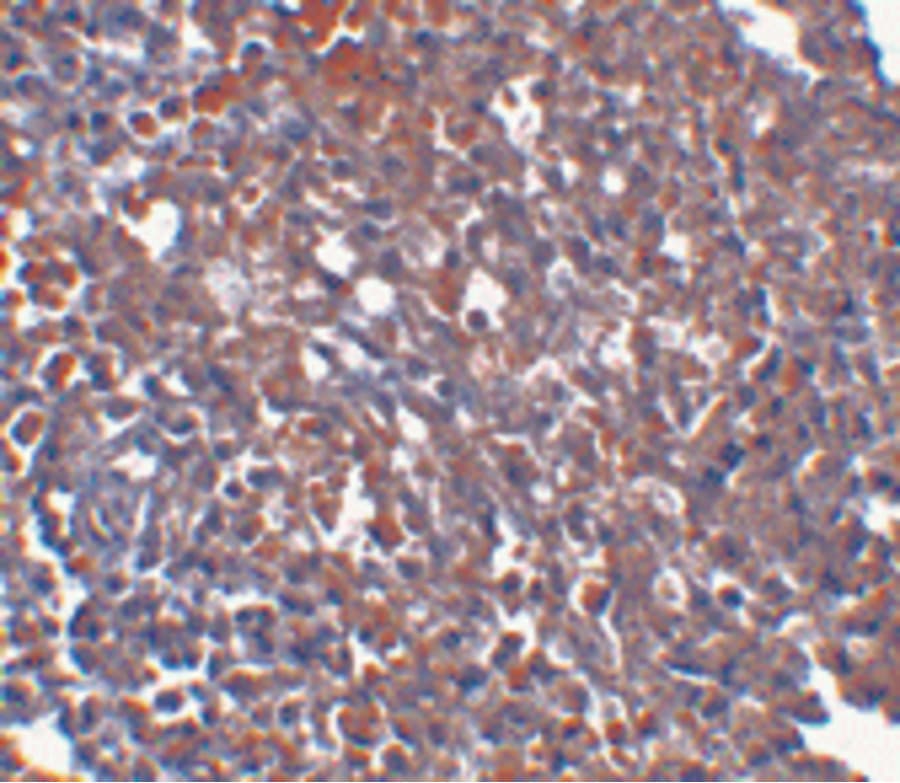 TMEM142A / ORAI1 Antibody (clone 6D11A11)