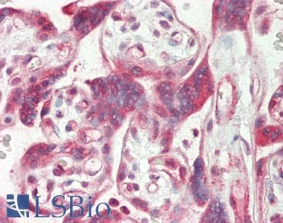 IHC-plus™ Polyclonal Rabbit anti-Human NFKBIA / IKB Alpha / IKBA Antibody (aa15-64, IHC, WB)