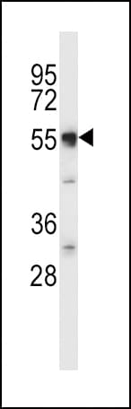 Polyclonal Rabbit anti-Human SLC11A2 / DMT1 Antibody (aa262-291, IF, WB)