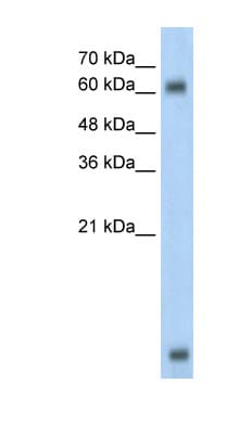 Polyclonal Rabbit anti-Human MBD1 Antibody (C-Terminus, IHC, WB)