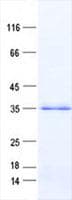Human ACOT8 Protein (Recombinant His, N-Terminal)