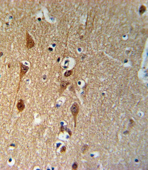 Polyclonal Rabbit anti-Human SMAD3 Antibody (aa186-215, IHC, IF, WB)