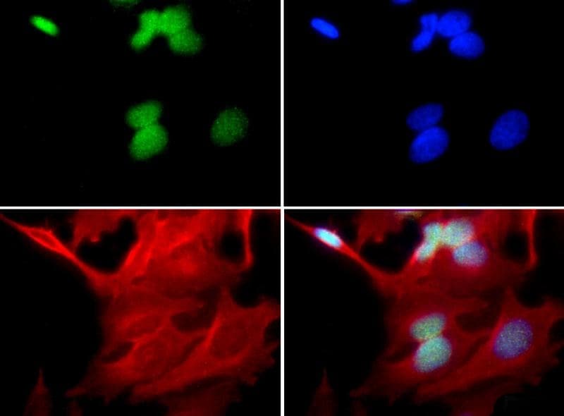 UBE2E1 / UBCH6 Antibody