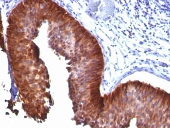 KRT18 / CK18 / Cytokeratin 18 Antibody (clone KRT18/835)