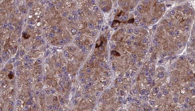 OR17-40 / OR3A1 Antibody