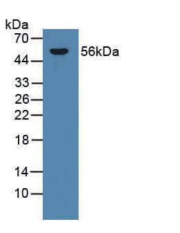 CYP21A2 Antibody (aa106-389, PE)