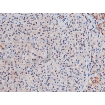 STAT3 Antibody (phospho-Ser727)