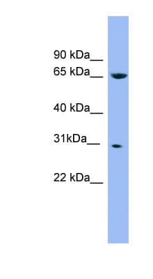 Polyclonal Rabbit anti-Human NDUFS3 Antibody (C-Terminus, WB)