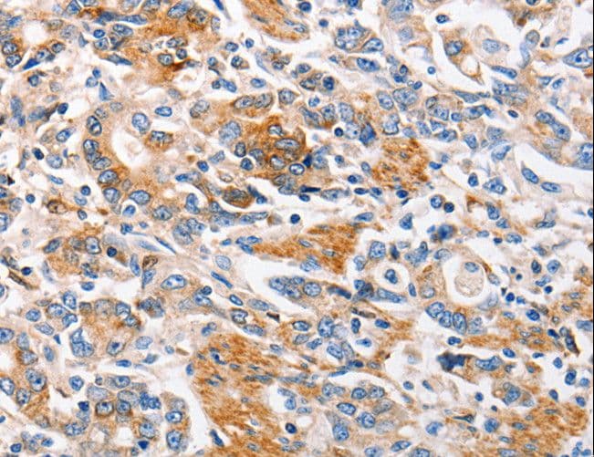 Polyclonal Rabbit anti-Human MC1R Antibody (IHC)