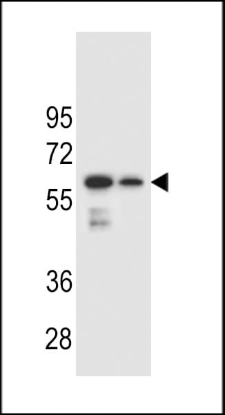CHST3 Antibody (aa25-54)