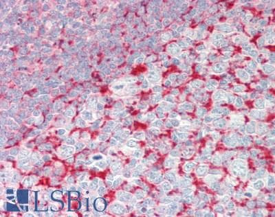 IHC-plus™ Polyclonal Rabbit anti-Human MAP4 Antibody (aa1102-1152, IHC, WB)