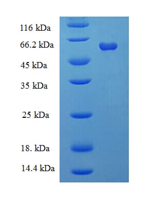 Human GALT Protein (Recombinant His-SUMO)