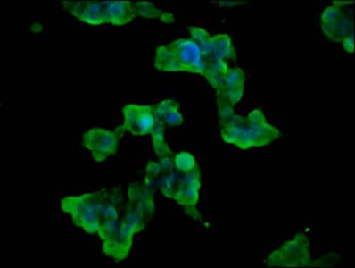 Polyclonal Rabbit anti-Human WNK3 / PRKWNK3 Antibody (IF)