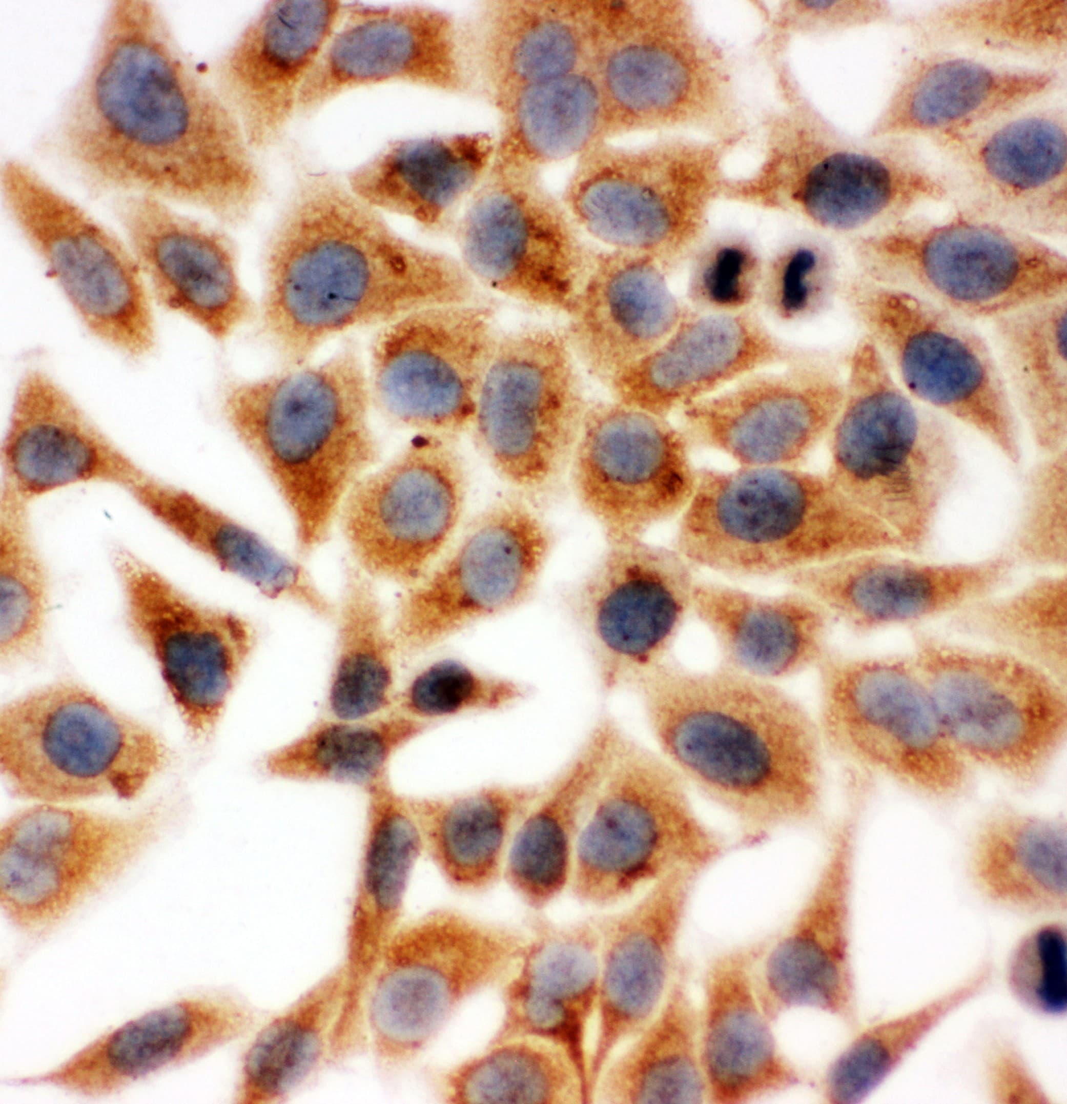 Polyclonal Rabbit anti-Human HSD17 / HSD17B1 Antibody (aa29-43, IHC, WB)
