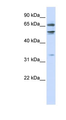 MED26 / CRSP7 Antibody (N-Terminus)