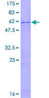 Human CDK5 Protein (Recombinant GST)