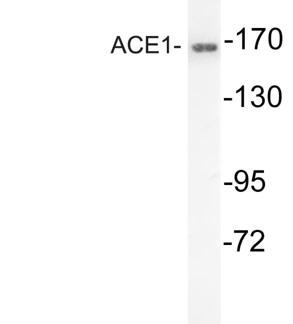 ACE / CD143 Antibody (aa891-940)