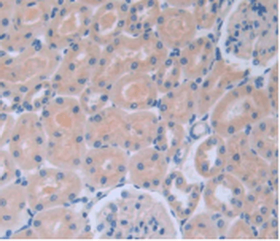 IL6 / Interleukin 6 Antibody (aa21-211, clone C8)
