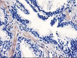 PPARA / PPAR Alpha Antibody (aa145-420, clone OTI2G6)