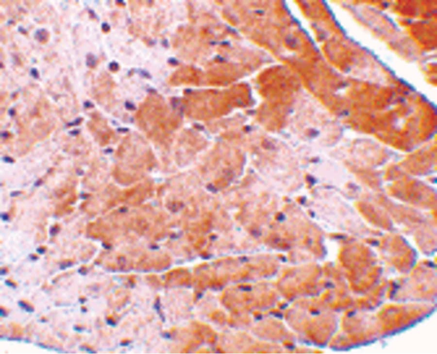 Polyclonal Rabbit anti-Human CIDEA / CIDE-A Antibody (IHC, IF, WB)