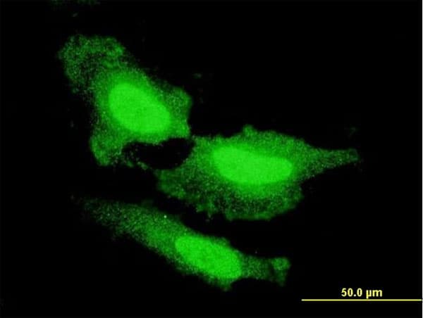 PathPlus™ FGF1 / Acidic FGF Antibody (clone 2E12)