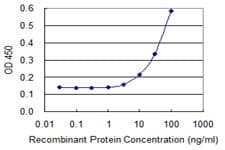 CTRB1 / Chymotrypsinogen B1 Antibody (clone 3C8)