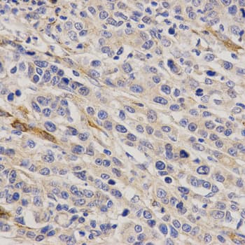 Polyclonal Rabbit anti-Human GHRH Antibody (IHC, WB)