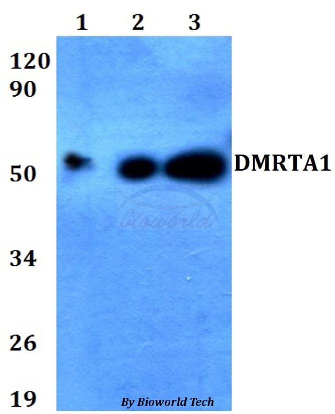 Polyclonal Rabbit anti-Human DMRTA1 Antibody (WB)