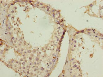 SPCS2 Antibody