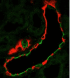 SCNN1A / ENaC Alpha Antibody (clone 2G4)