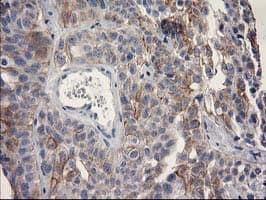 OSGEP Antibody (clone OTI8B3)