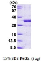 Human FGF14 Protein (Recombinant His)