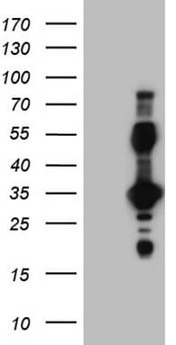 EPOR / EPO Receptor Antibody (aa25-250, clone OTI4F12)