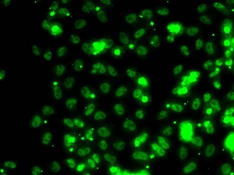 Polyclonal Rabbit anti-Human SECISBP2 / SBP2 Antibody (IHC, IF, WB)