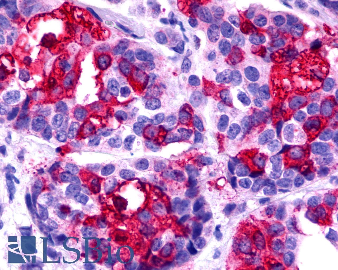 IHC-plus™ Polyclonal Rabbit anti-Human ACKR4 / CCRL1 / CCR11 Antibody (Cytoplasmic Domain, IHC)