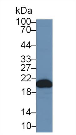 PPIB / Cyclophilin B Antibody (aa47-216)