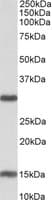 SIRT3 / Sirtuin 3 Antibody (aa170-183)