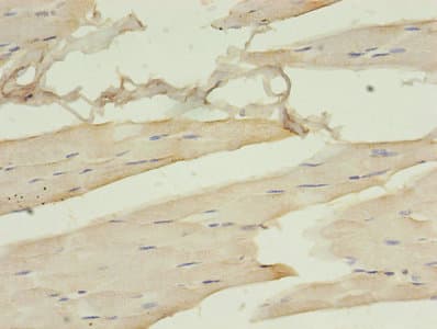 DCX / Doublecortin Antibody