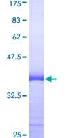 Human SRSF10 / FUSIP1 Protein (Recombinant GST, N-terminus)