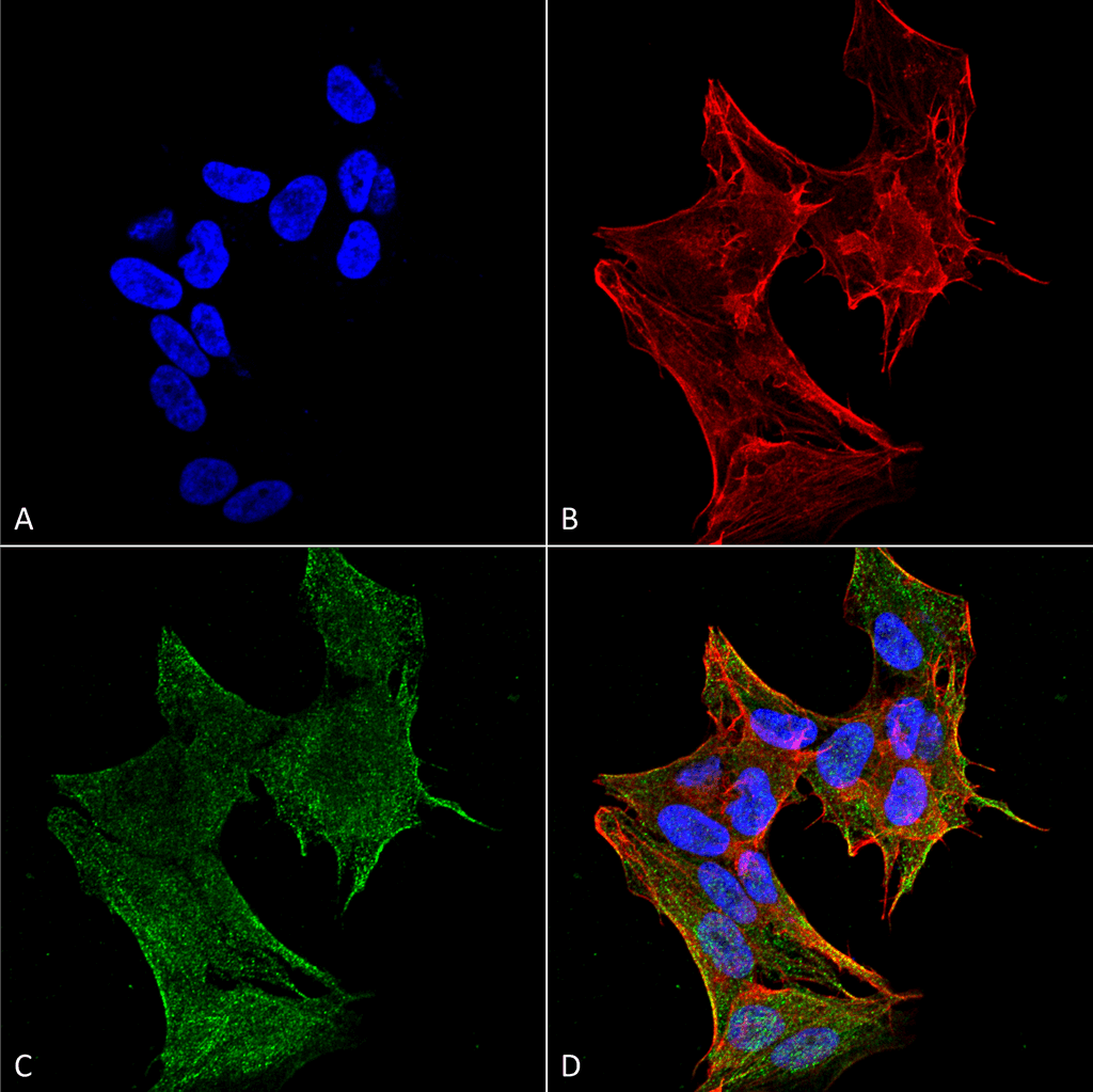 TG737 / IFT88 Antibody (Atto 594)